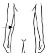 oval hipbones